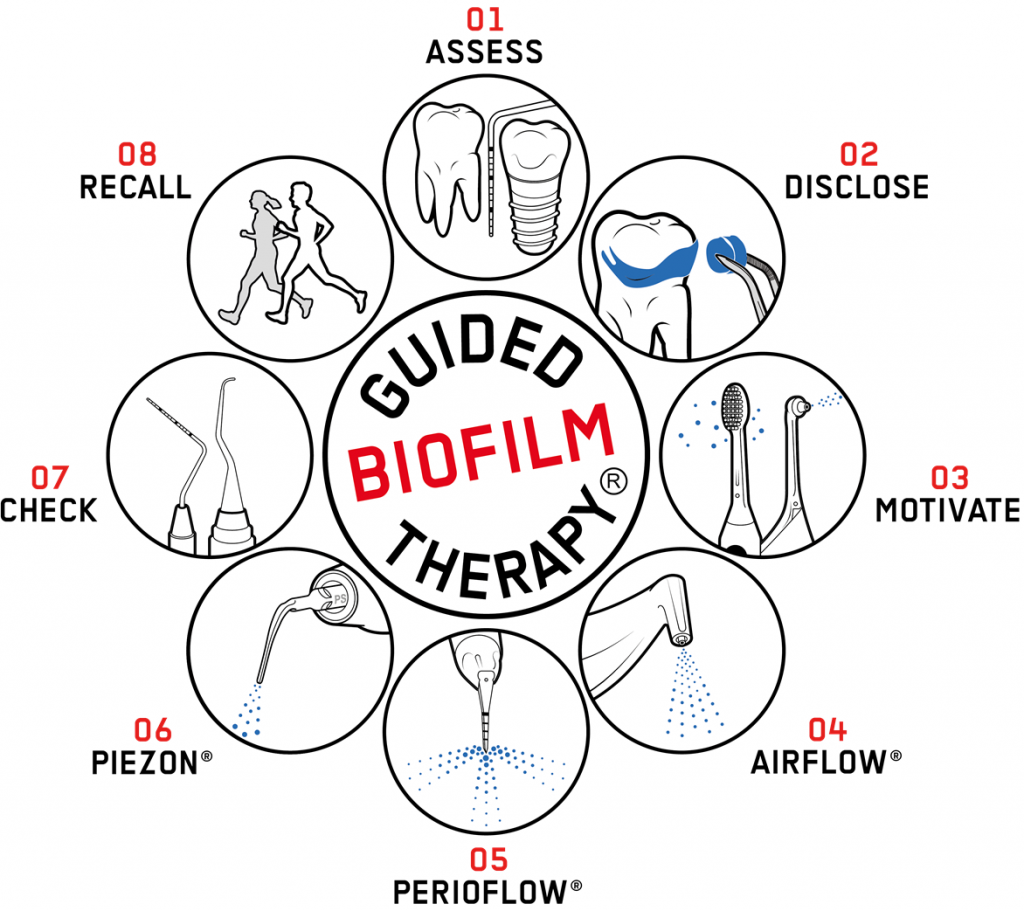 Guided Biofilm Therapy Diagram